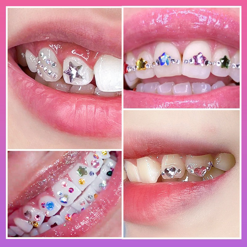 NEW Professional Tooth Gem Kit - огляд і ціна Tooth Gem Kit