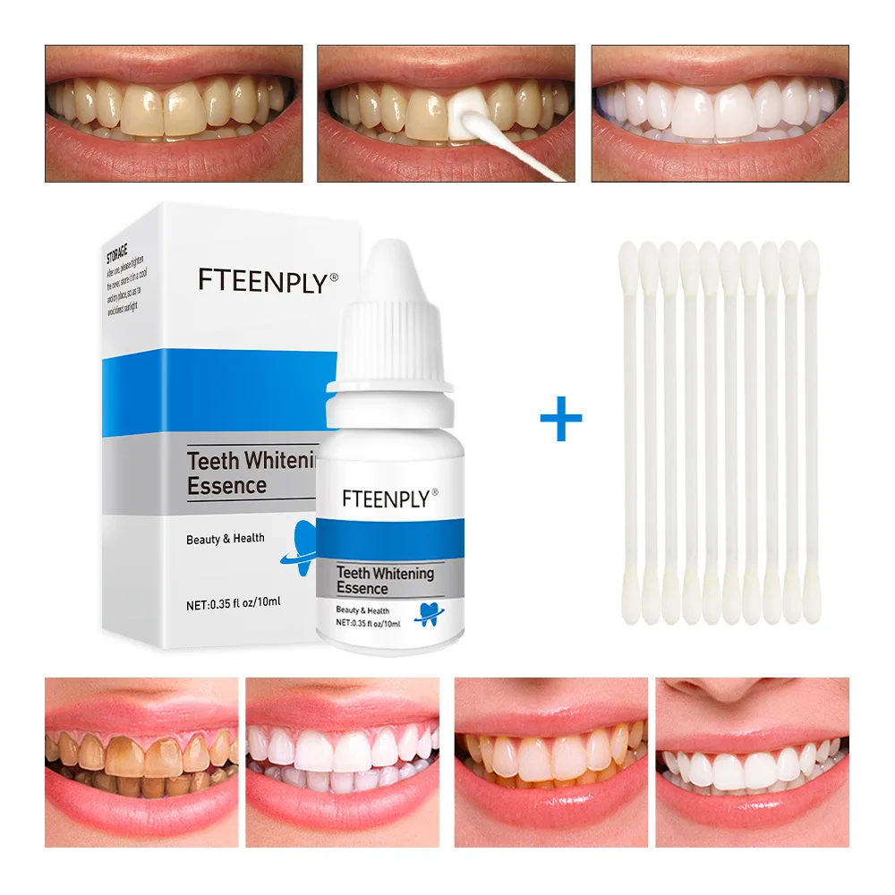 FTEENPLY Teeth Whitening Essen - огляд і ціна Teeth Whitening/Bleaching