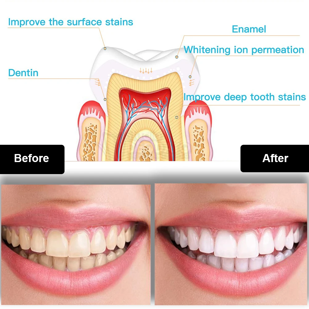 Dental Teeth Whitening Kit Min - огляд і ціна Teeth Whitening Light Kit