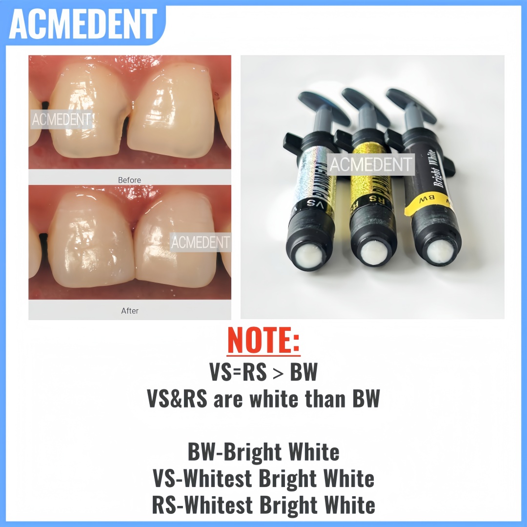 4.5g Dental Composite Resin Ve - огляд і ціна Teeth Whitening Vs Veneers