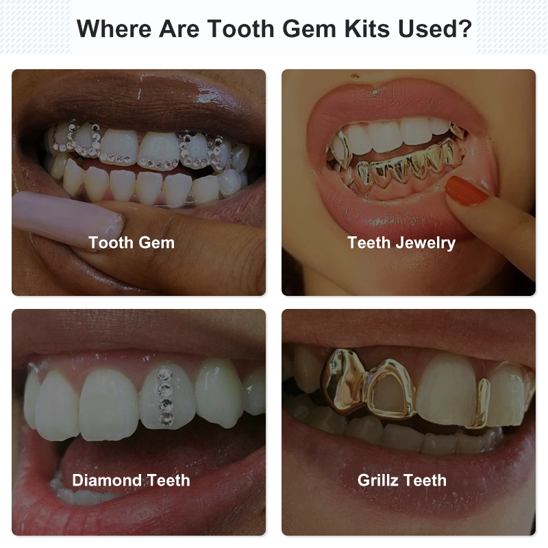 Tooth Gem Set Glue Kit with UV - огляд і ціна Tooth Gem Kit